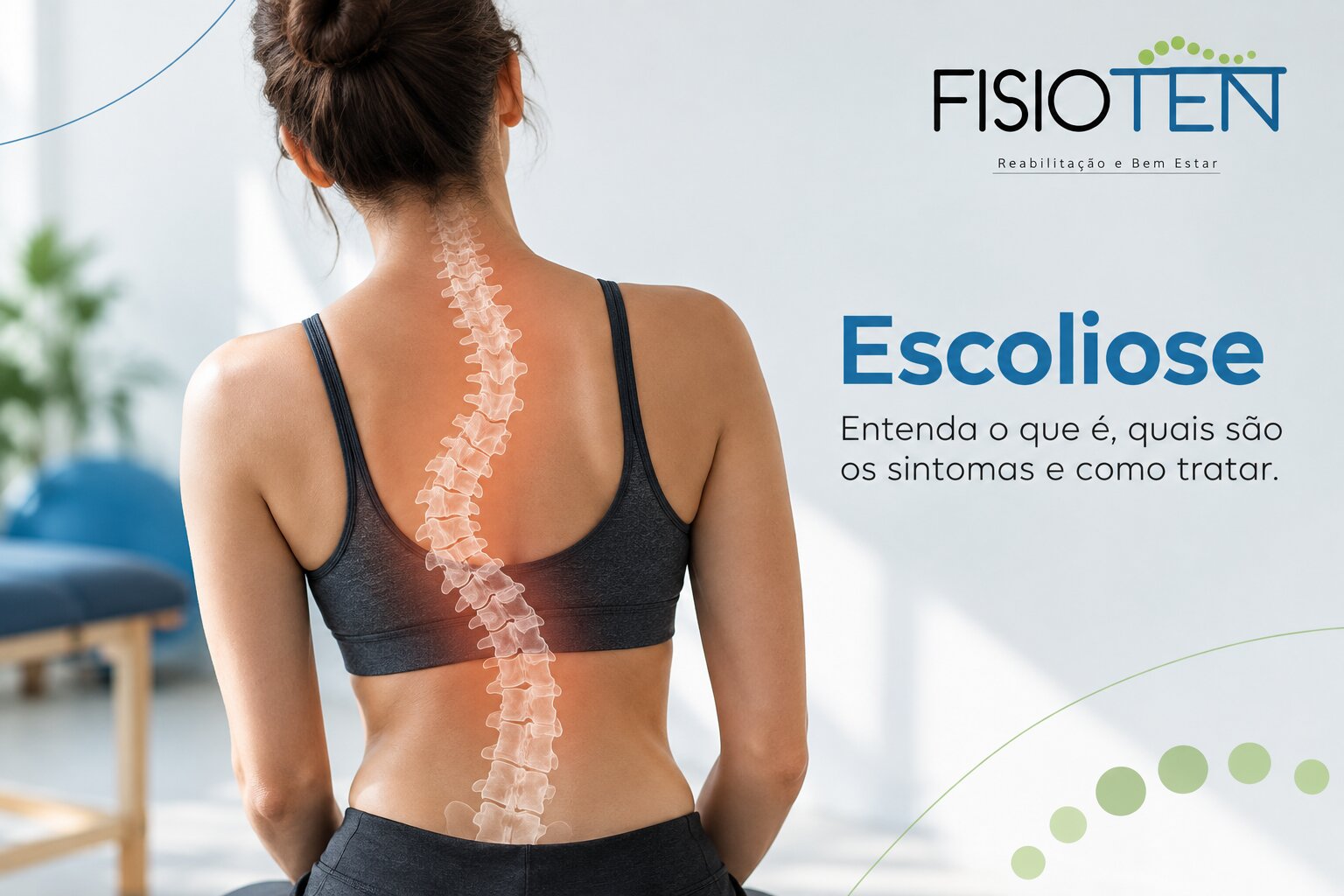 Imagem do artigo Escoliose em adultos: quando a fisioterapia pode ajudar?